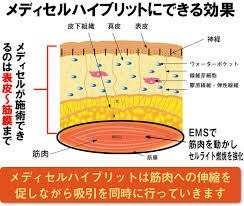 ハイブリッド